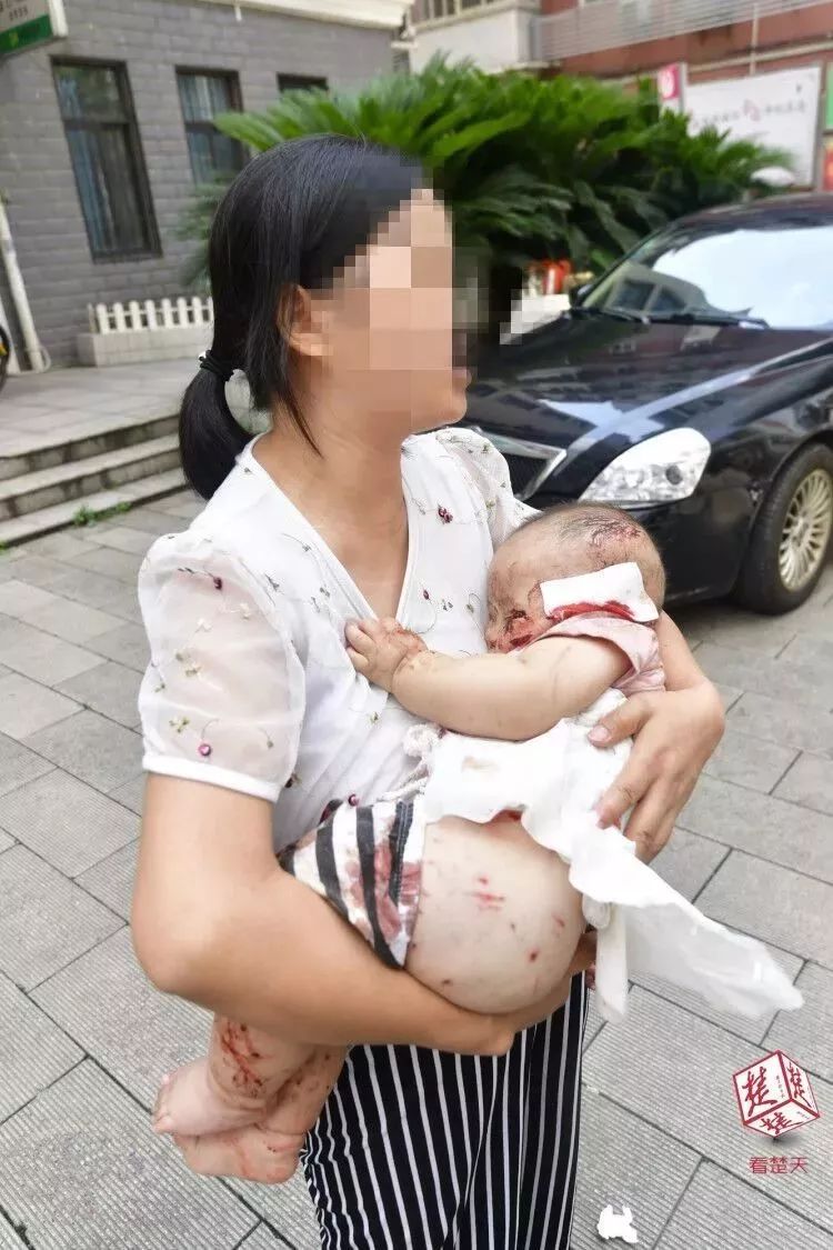 江西母女遭犬撕咬事件，深刻反思與探討