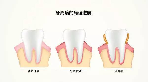 智能口腔護理，預(yù)防牙病的新選擇