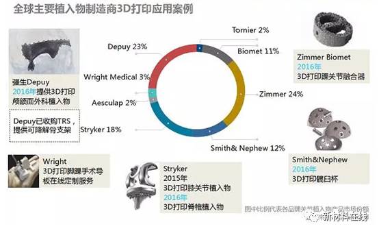 3D打印技術(shù)推動(dòng)醫(yī)療器械定制化革新之路