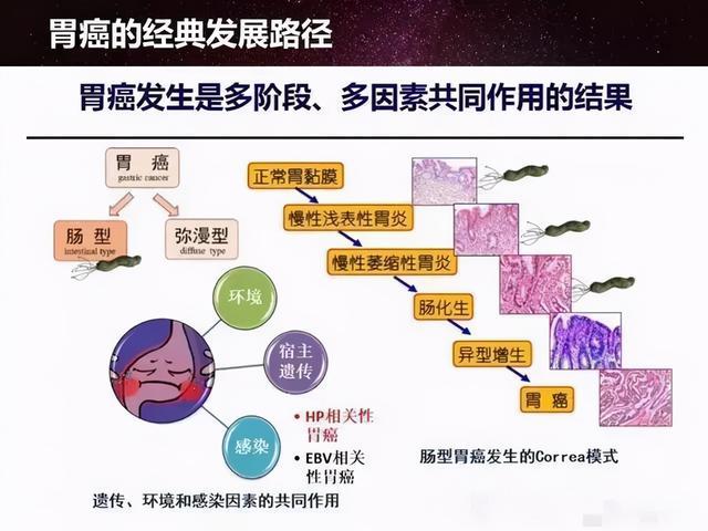 定期更換筷子可降低胃癌風險研究揭示