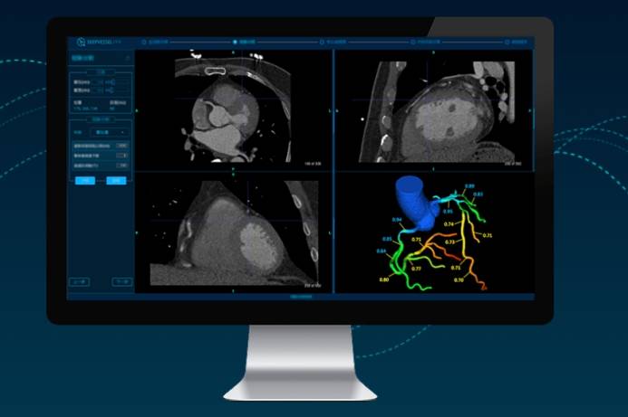 視覺分析系統(tǒng)助力醫(yī)學(xué)影像診斷的新方向探索
