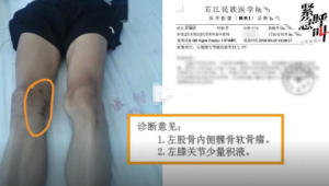 体育生右膝被误伤，母亲拒绝和解，正义与公正之战